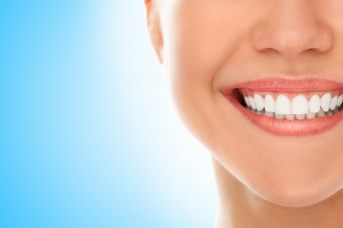 TEETH WHITENING (BLEACHING)